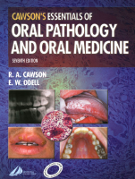 Essentials of Oral Pathology and Oral Medicine.pdf